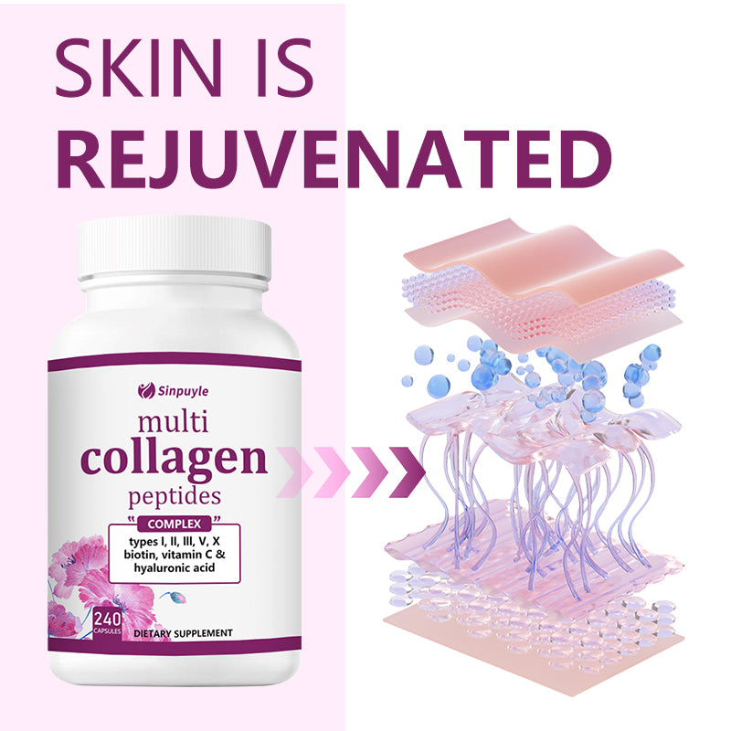 Multi Collagen Complex for Women, 90 Capsules Type I, II, III, V, X with Hyaluronic Acid, Biotin, & Vitamin C Hydrolyzed Protein Peptides Keto & Paleo Friendly